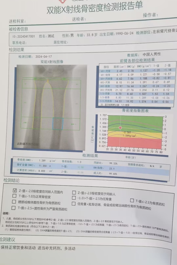 雙能X射線骨密度儀：準確測量骨密度，助力骨質(zhì)疏松防治，守護骨骼健康